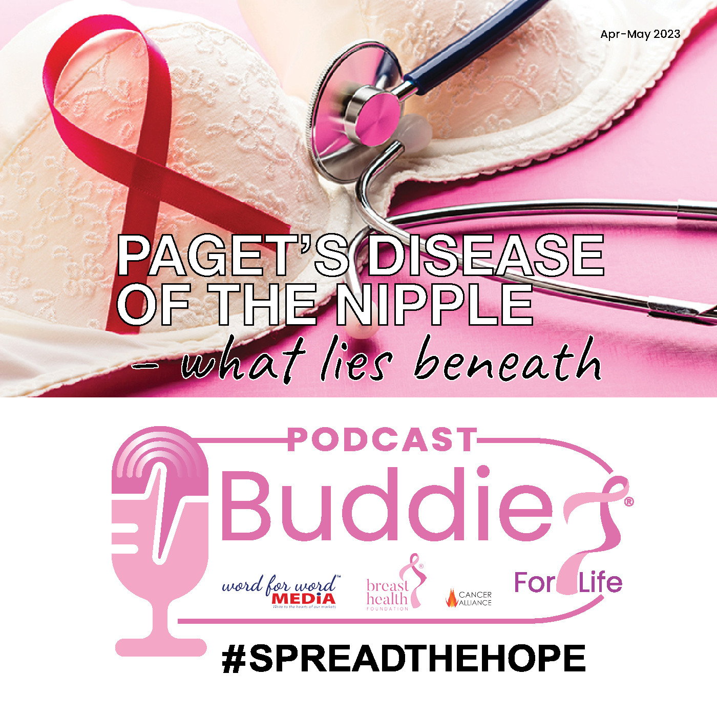 Paget's disease of the nipple - what lies beneath episode artwork