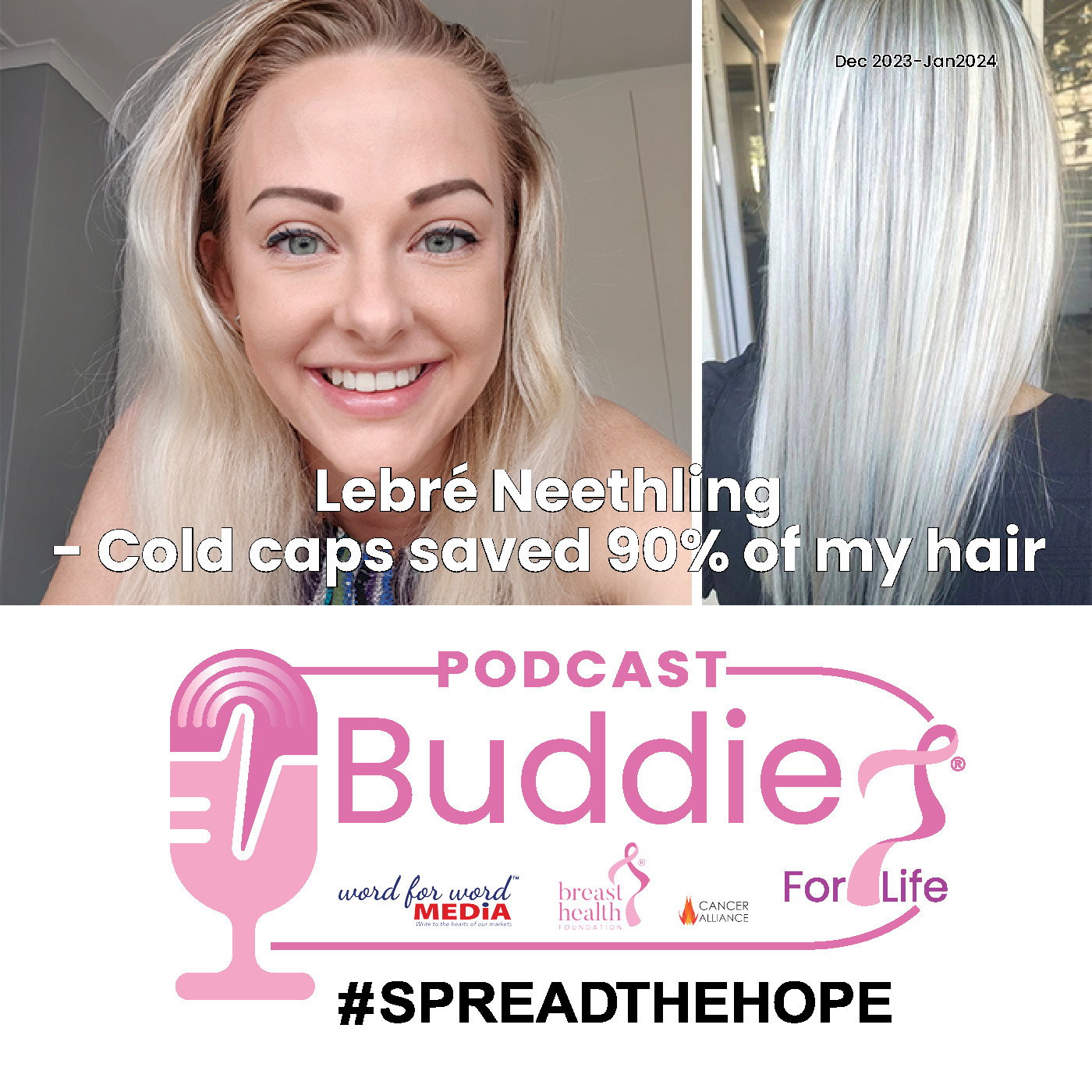Cold caps saved 90% of my hair episode artwork