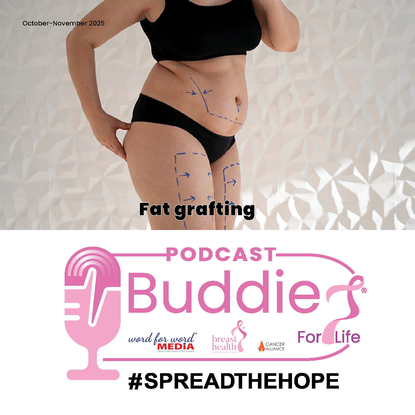Fat grafting episode artwork