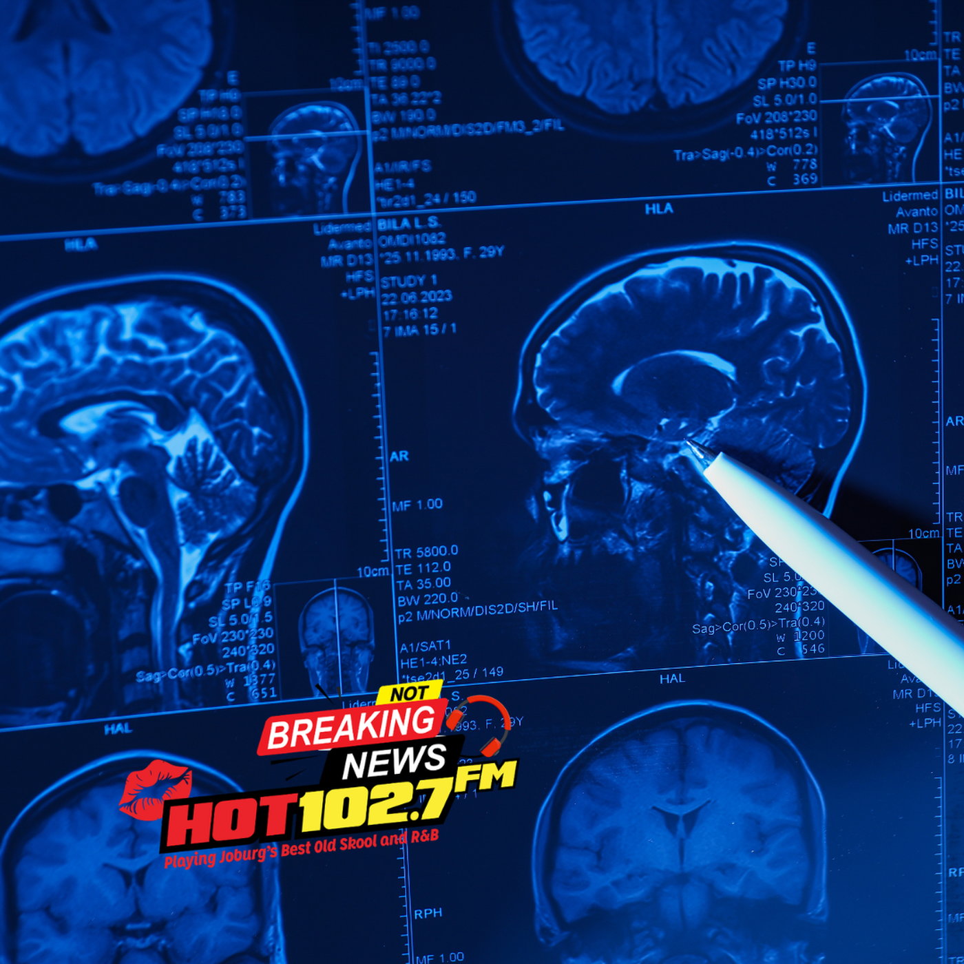 Beyond Tremors: The Hidden Reality of Parkinson’s episode artwork